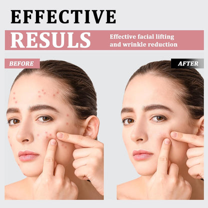 MicroCurrent Facial Shaping Tool