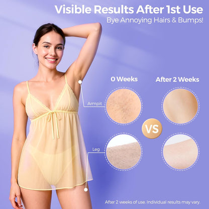 2026 Upgraded Laser Hair Removal